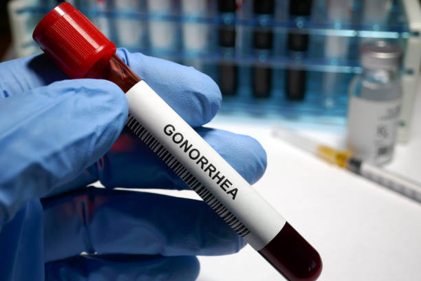 Gonorrhea - sexually transmitted disease blood test and treatment